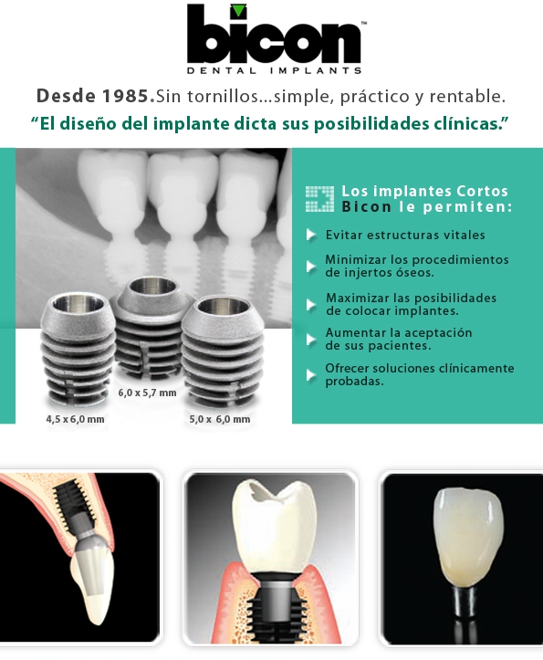 Implante dental Bicon en centro odontologico Puerto Madero