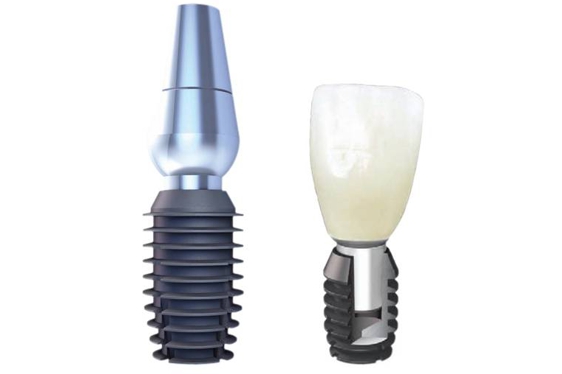 consultorio odontologico caba implante dental, protesis